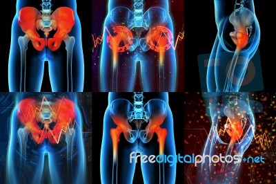 3d Rendering  Medical Illustration Of A Painful Sacrum Stock Image