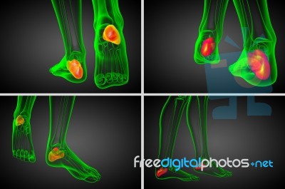 3d Rendering Medical Illustration Of The Calcaneus Bone Stock Image