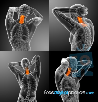 3d Rendering Medical Illustration Of The Cervical Spine Stock Image