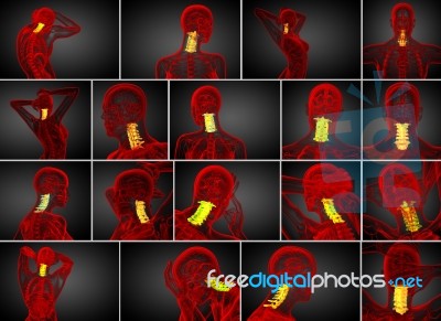 3d Rendering Medical Illustration Of The Cervical Spine Stock Image