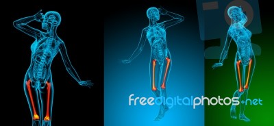 3d Rendering Medical Illustration Of The Femur Bone Stock Image