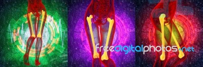 3d Rendering Medical Illustration Of The Femur Bone Stock Image