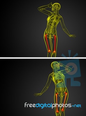 3d Rendering Medical Illustration Of The Femur Bone Stock Image