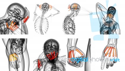 3d Rendering Medical Illustration Of The Metacarpal Bone Stock Image