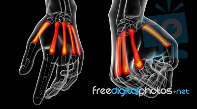 3d Rendering Medical Illustration Of The Metacarpal Bone Stock Image