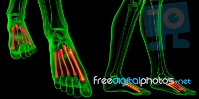 3d Rendering Medical Illustration Of The Metatarsal Bones Stock Image