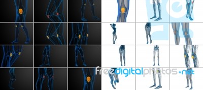 3d Rendering  Medical Illustration Of The Patella Bone Stock Image