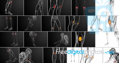 3d Rendering Medical Illustration Of The Patella Bone Stock Image