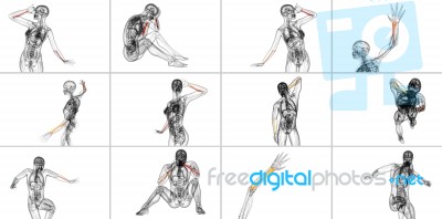 3d Rendering Medical Illustration Of The Radius Bone Stock Image