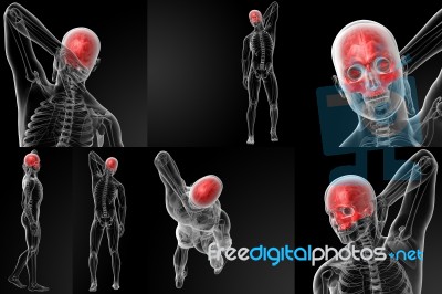 3d Rendering Of  Human Skull - Upper Half Stock Image