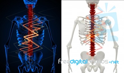 3d Rendering Skeleton Of The Man With The Backache Stock Image