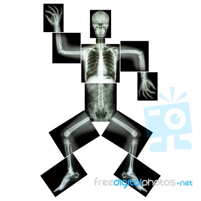 Aerobic Dance(human Bone Is Dancing),(whole Body X-ray : Head ,neck ,thorax ,shoulder ,arm ,elbow ,forearm ,hand ,finger ,joint ,thorax ,abdomen ,back,pelvis ,hip ,thigh ,leg ,knee ,foot ,heel ,ankle) Stock Photo