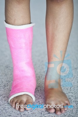 Ankle Sprain Stock Photo