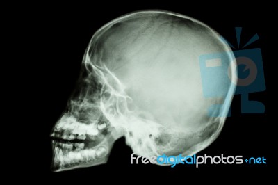 Asian Child's Skull (thai People) Stock Photo