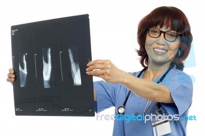 Asian Surgeon Showing Xray Report Stock Photo