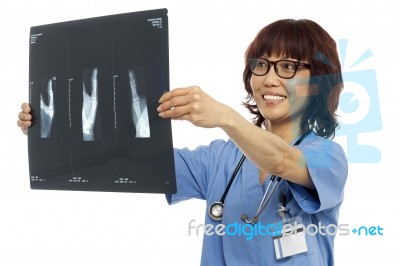 Asian Surgeon Showing Xray Report Stock Photo