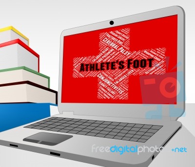 Athlete's Foot Means Poor Health And Affliction Stock Image