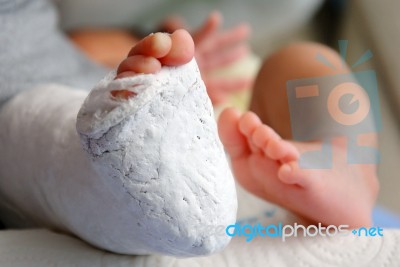 Baby Foot In Bandage And Cast Stock Photo