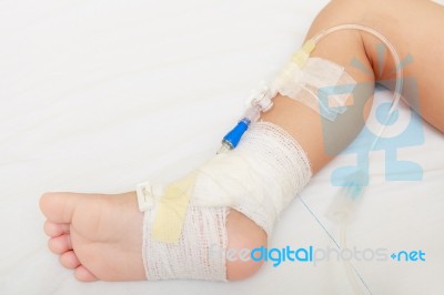 Bandage On Baby Leg Stock Photo