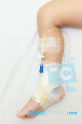 Bandage On Babys Leg Stock Photo