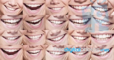 Big Beautiful Smiles And White Teeth Stock Photo