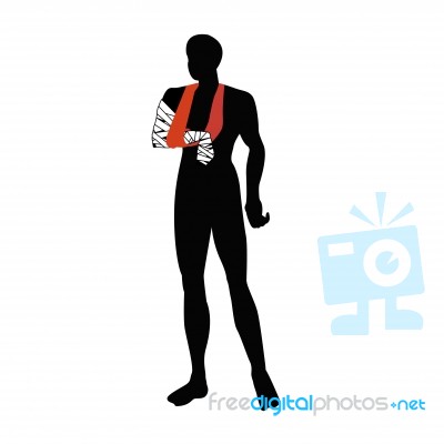 Black Man With Arm Splint Stock Image