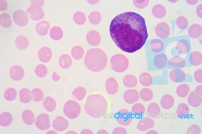 Blood With Red Blood Cells.medical Science Background Stock Photo