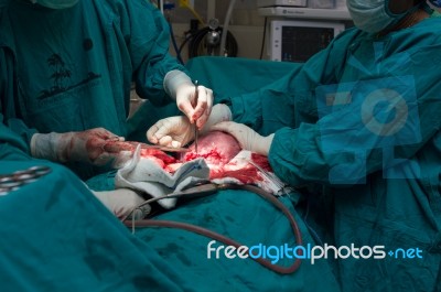 Cesarean Section Stock Photo