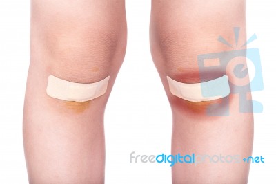 Child Knees With A Plaster (for Wounds) And Bruise Stock Photo