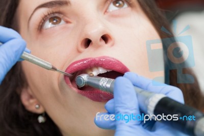 Close-up Medical Dentist Procedure Of Teeth Polish Stock Photo