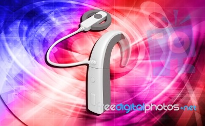 Cochlear Implant Stock Image