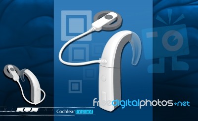 Cochlear Implant Stock Image