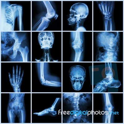 Collection Human Joint ( Skull Head Neck Shoulder Chest Thorax Shoulder Arm Elbow Forearm Wrist Hand Finger Palm Spine Back Pelvis Thigh Knee Leg Foot Ankle Toe) Stock Photo