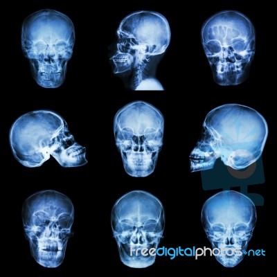 Collection Of Asian Skull Stock Photo