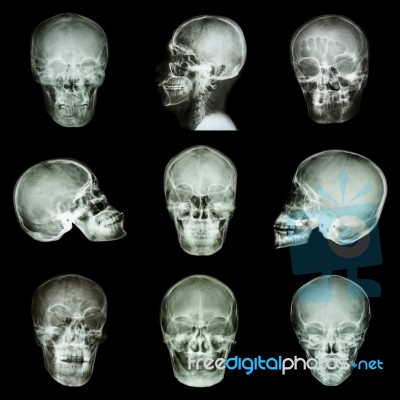 Collection Of Asian Skull Stock Photo