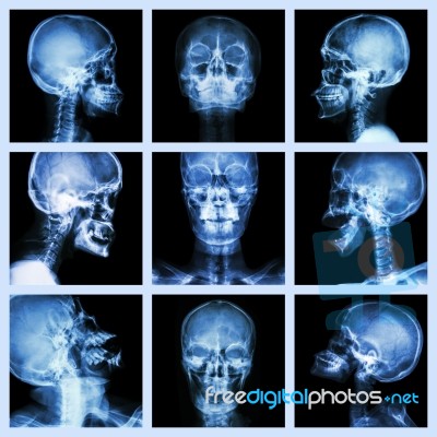 Collection Of Asian Skull (thai People) Stock Photo