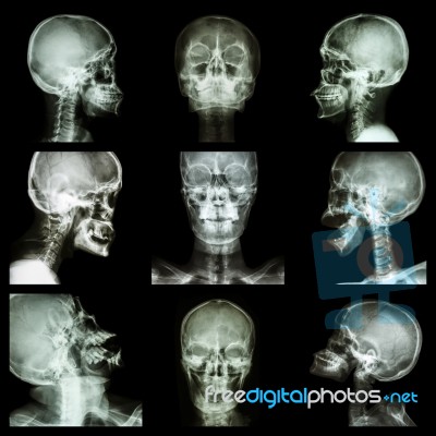 Collection Of Asian Skull (thai People) Stock Photo