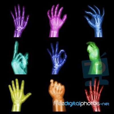 Collection Of Colorful X-ray Hands Stock Photo