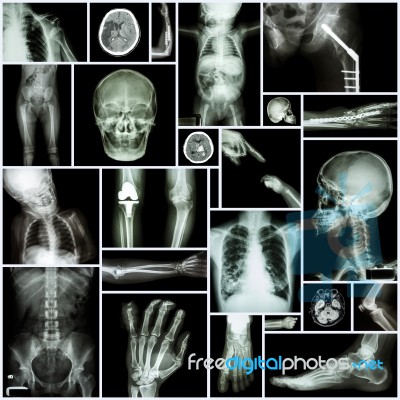 Collection X-ray 