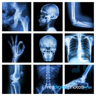 Collection X-ray Part Of Human Stock Photo