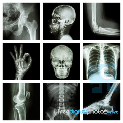 Collection X-ray Part Of Human Stock Photo