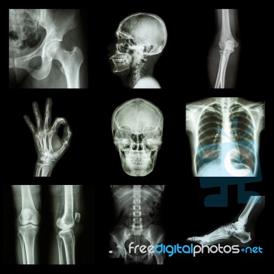 Collection X-ray Part Of Human Stock Photo