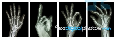 Collection X-ray Symbol Hands Stock Photo