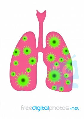 Coronavirus In Human Lungs Stock Image