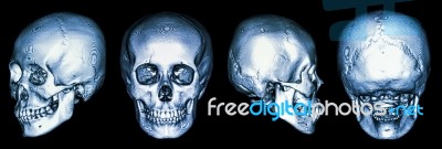 Ct Scan Of Human Skull And 3d Stock Photo