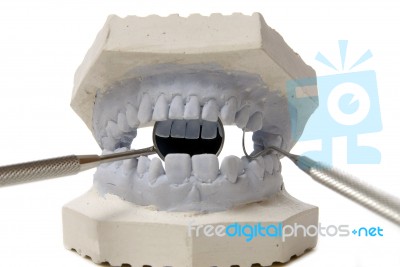 Dental Examining Stock Photo