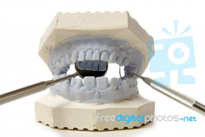 Dental Examining Stock Photo