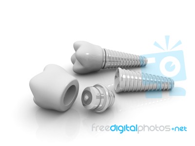 Dental Implant 3d Crown With Pin Stock Image