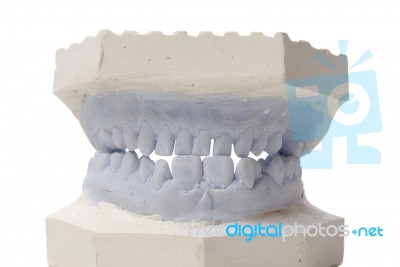 Dental Model Stock Photo