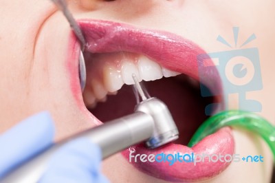 Dentist Curing A Female Patient Stock Photo